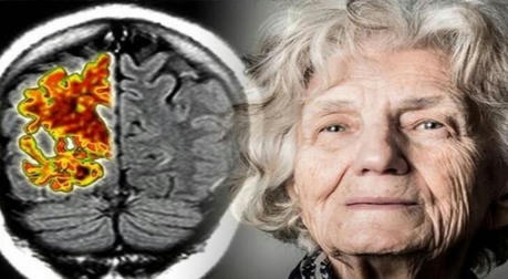 Caring for Dementia Patients: Effective Strategies to Manage Anxiety and Resistance